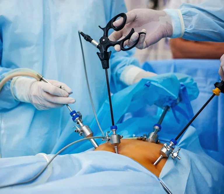 laparoscopic